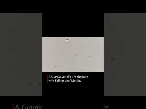 Falling-Leaf Motility of Giardia lamblia | NEJM