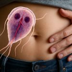 Lambliasis Unveiled: The Hidden Threat of Giardia lamblia Infection